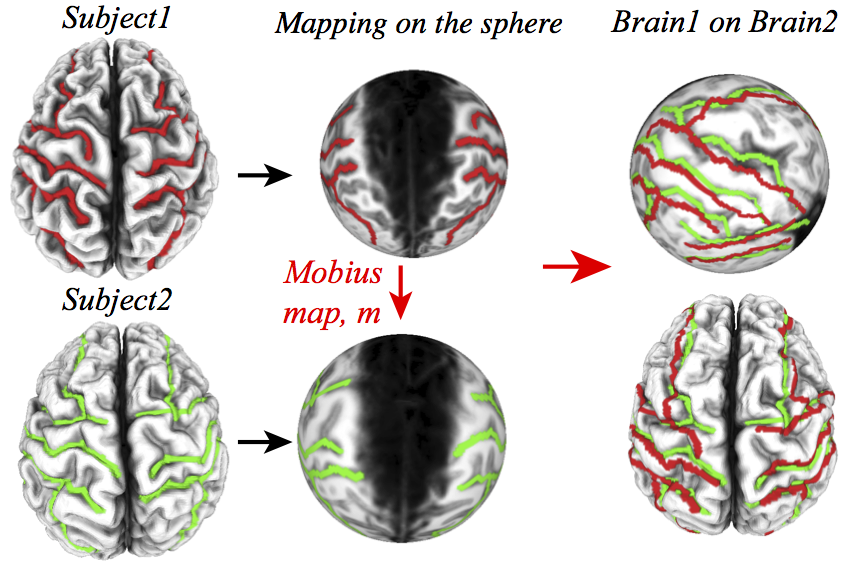 brain mapping procedure